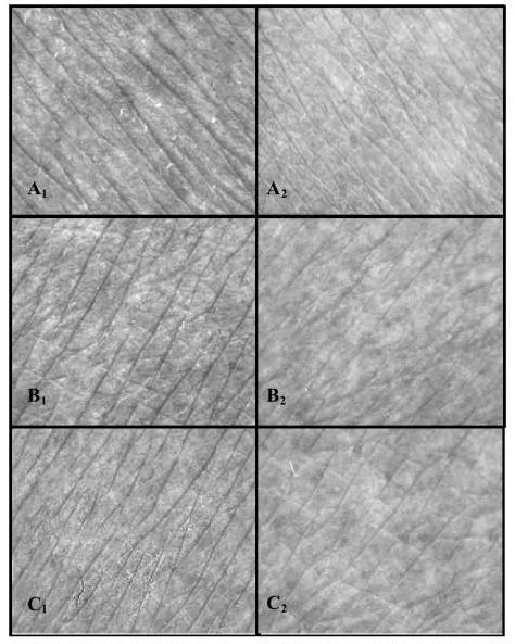 Comparison of skin texture before and after 30 days of using Oat Beta Glucan