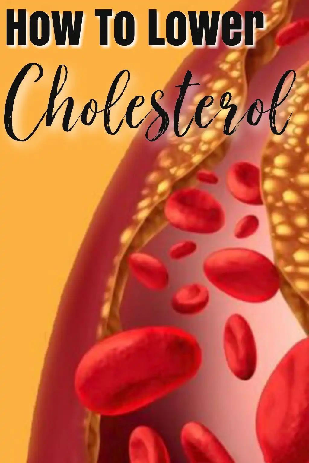 Dihydromyricetin can lower cholesterol levels Dihydromyricetin can lower cholesterol levels