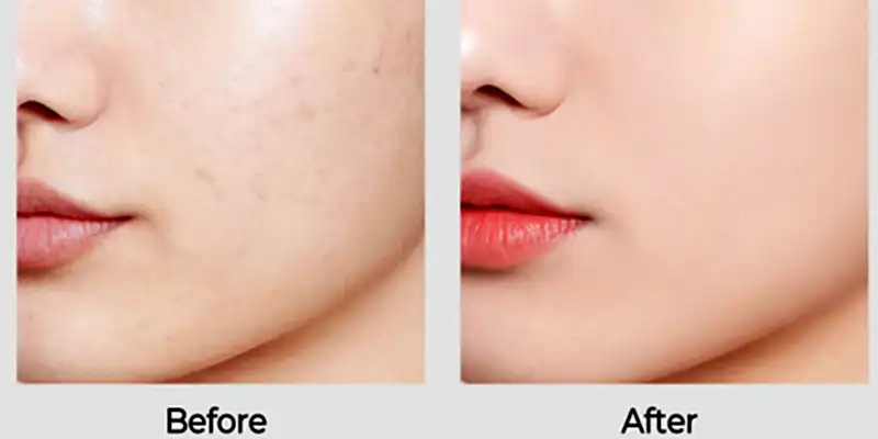 blog-800-400 blog-800-400
