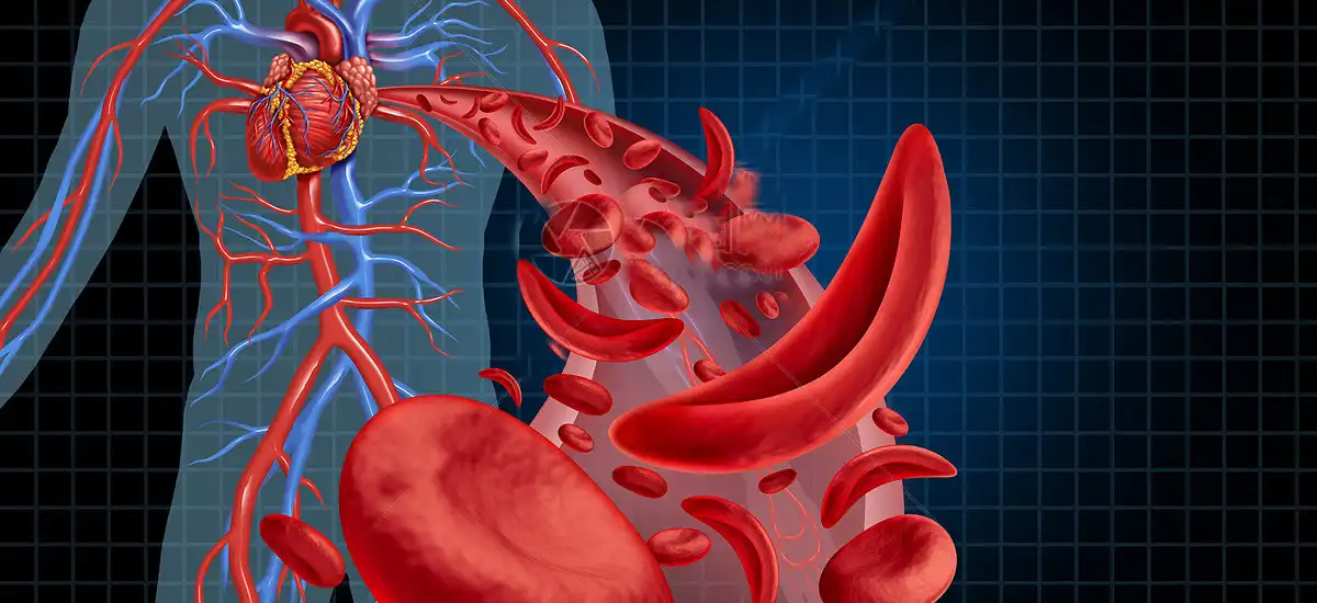 Anti-Inflammatory and Antioxidant Effects Anti-Inflammatory and Antioxidant Effects