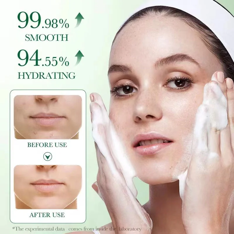 Centella Asiatica Extract can dilute acne marks Centella Asiatica Extract can dilute acne marks