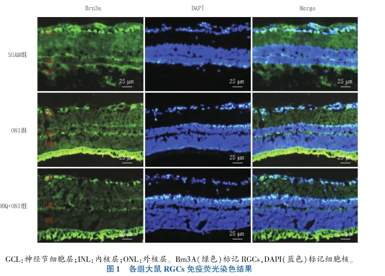 Immunofluorescence staining results of RGCs in each group of rats