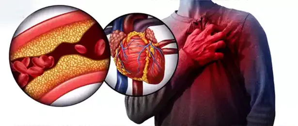 cardiovascular condition cardiovascular condition