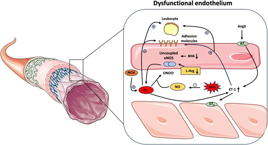 resveratrol Cardiovascular Protection