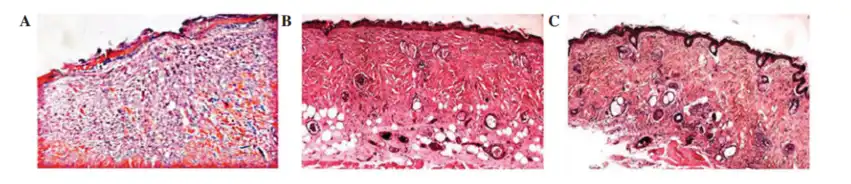 The Main Effects of Asiaticoside Powder The Main Effects of Asiaticoside Powder