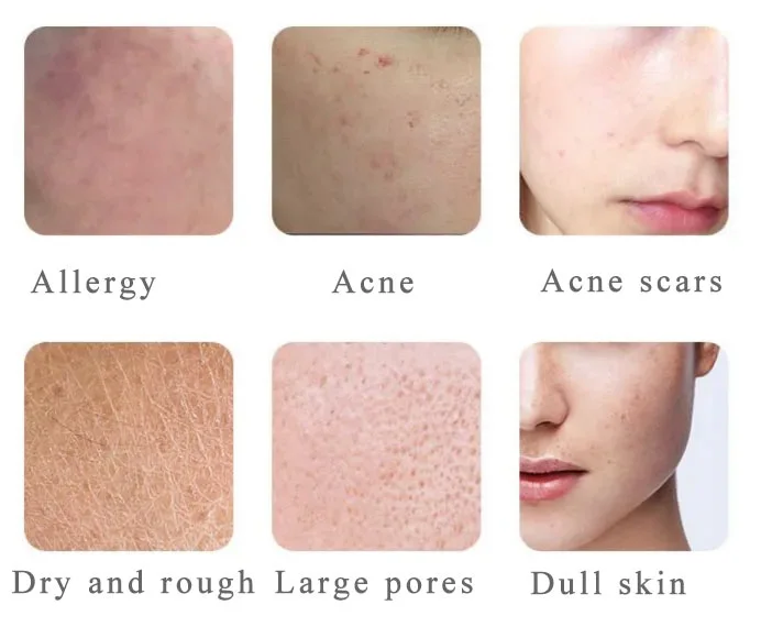 Applicable Symptoms of Centella Asiatica Extract Applicable Symptoms of Centella Asiatica Extract