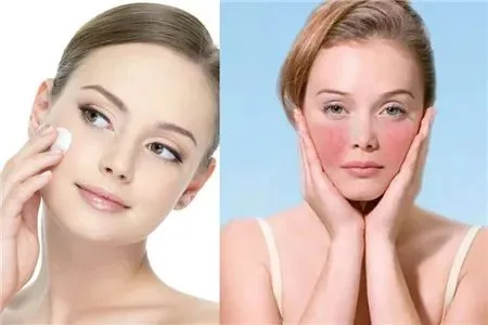 The Skin Care Benefits of Asiaticoside The Skin Care Benefits of Asiaticoside