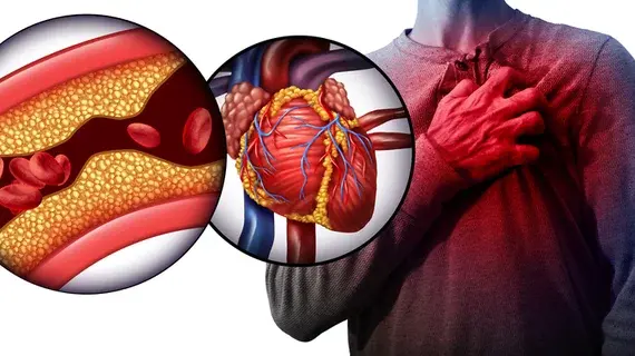 cardiovascular diseases
