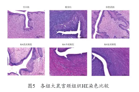 Anti-cervicitis effect and mechanism of rosmarinic acid