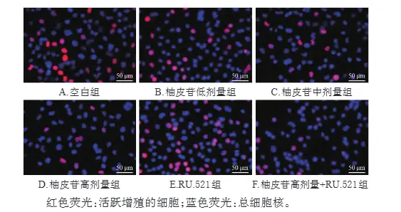 Effects of Naringin on breast cancer cell