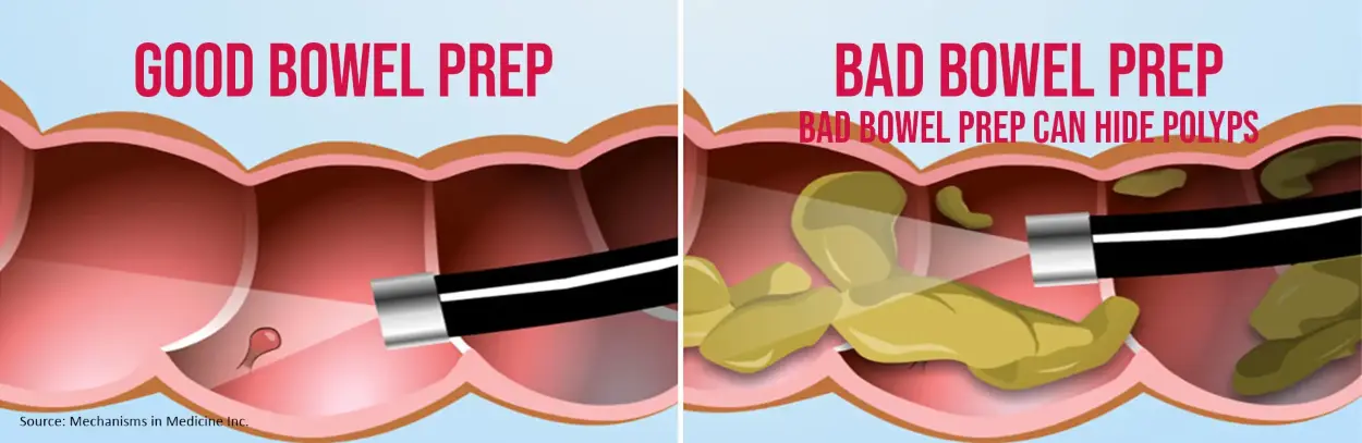 Senna Leaf Extract Benefits Senna Leaf Extract Benefits