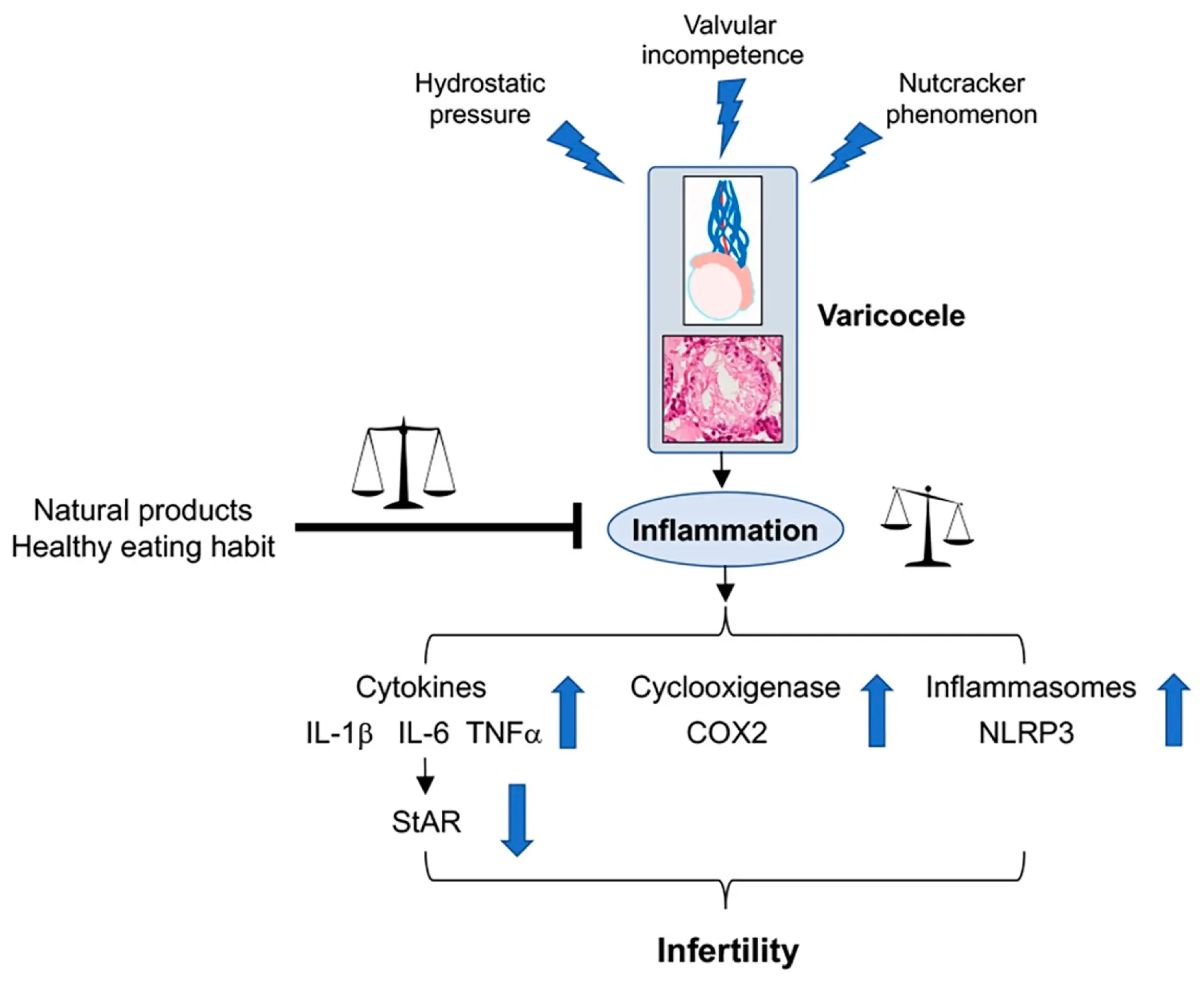 Horse Chestnut Extract Benefits