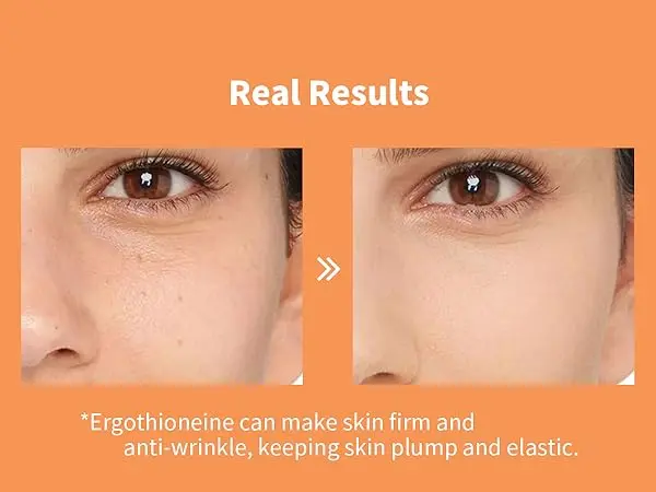 What's the Ergothioneine Skin benefits？