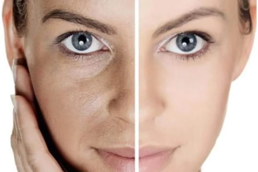 How Does Propolis Extract Work for Skincare? How Does Propolis Extract Work for Skincare?